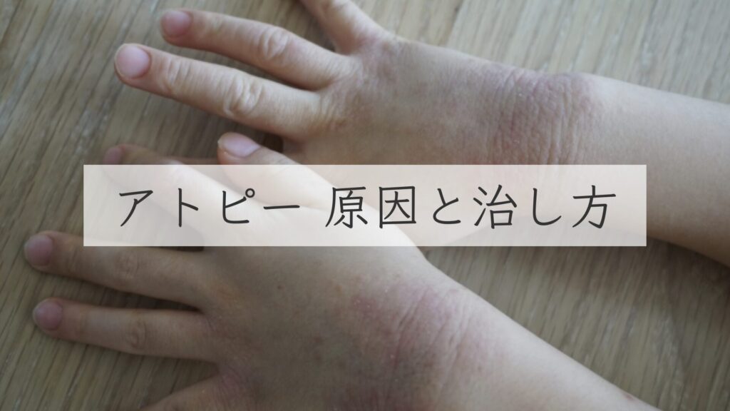 足の裏が痒い!かゆい原因、対策と治療方法を皮膚科医が解説 | 医療法人義恵会 公式サイト