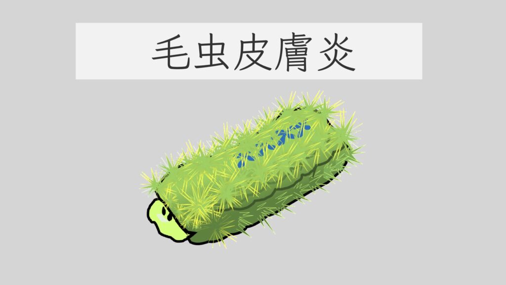 足の裏が痒い!かゆい原因、対策と治療方法を皮膚科医が解説 | 医療法人義恵会 公式サイト