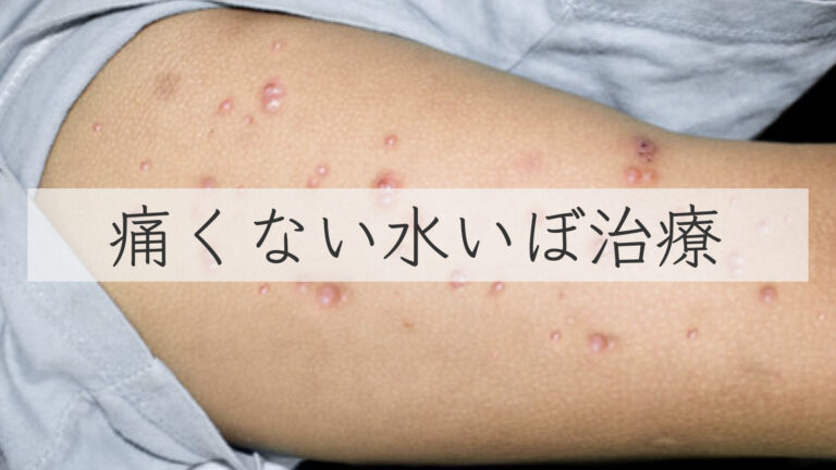 足の裏が痒い!かゆい原因、対策と治療方法を皮膚科医が解説 | 医療法人義恵会 公式サイト