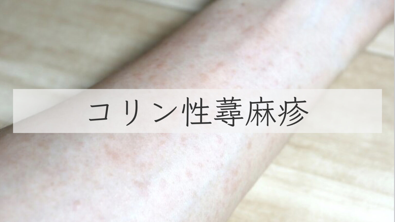 【虫刺され】『ダニ』に刺されたらどうすればいい?症状と具体的な対策を現役皮膚科医がわかりやすく解説【イエダニ、マダニ、跡を残さない】 | 皮膚 ...